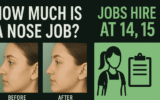 How Much Is a Nose Job and What Jobs Hire at 14, 15